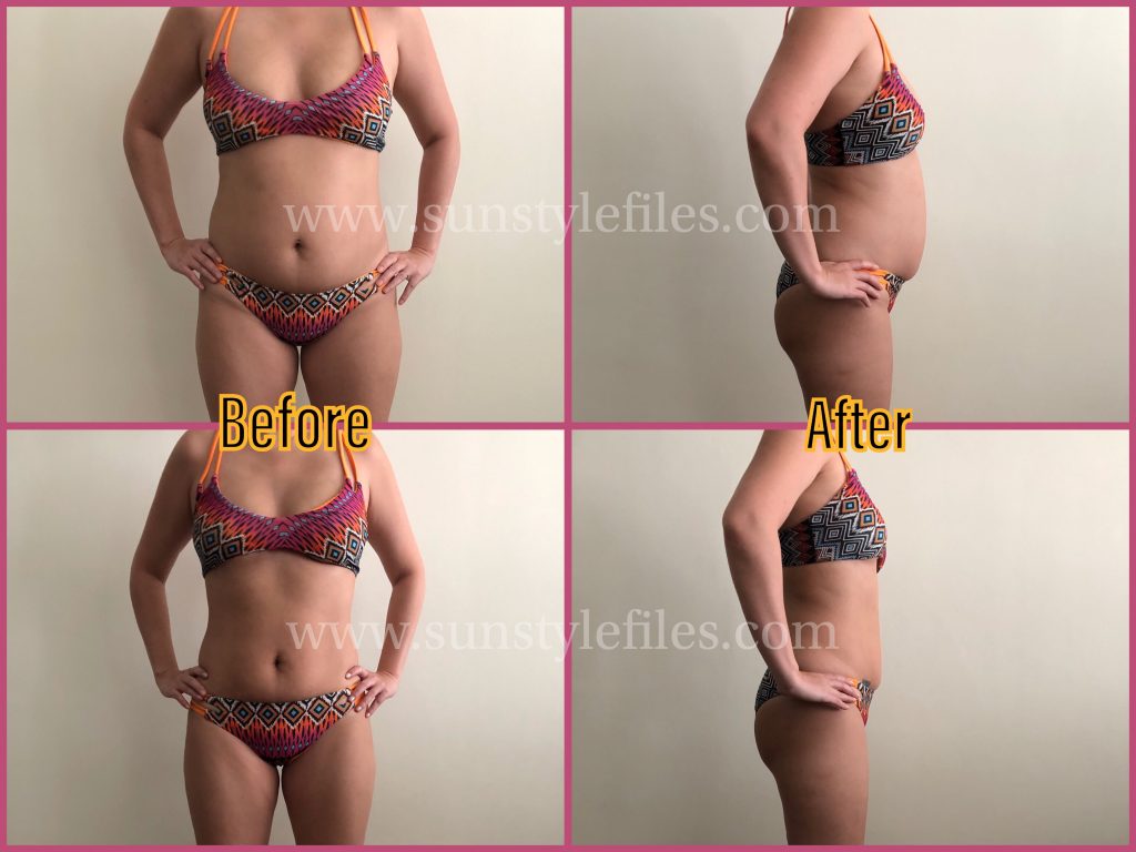 hcg diet before and after photos of woman in bikini showing inch losses