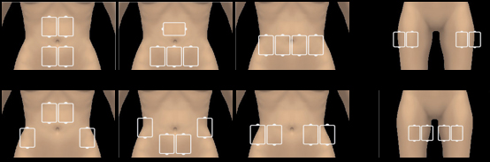 parts division for le shape treatment