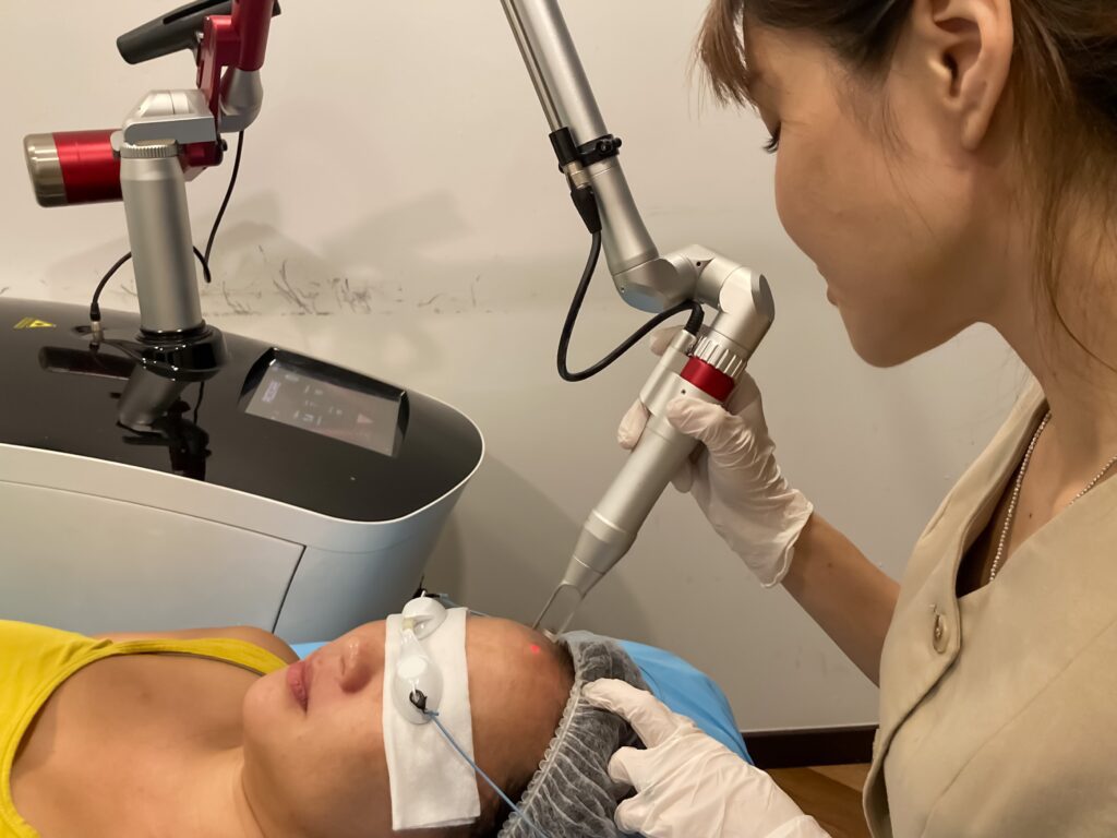doctor using a pico laser machine on face